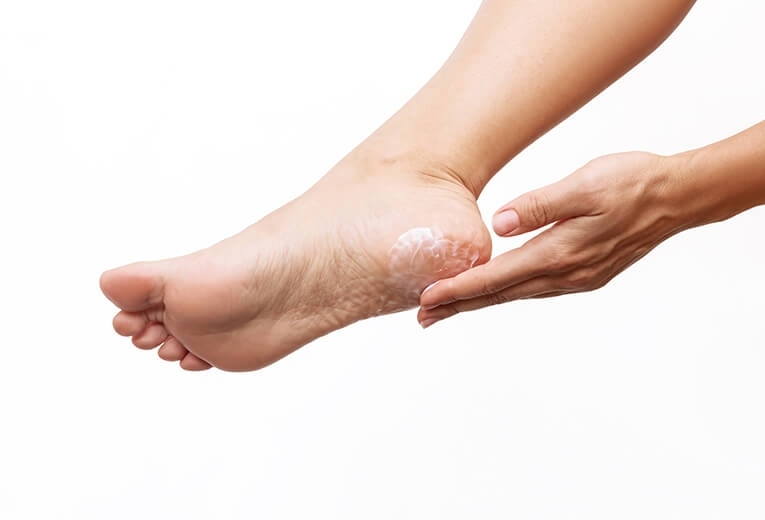 Bolle sotto i piedi: come curarle? Plantari Corazza Bolle sotto i piedi: come curarle? Plantari Corazza