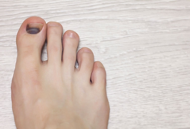 L Unghia Nera Corazza Group